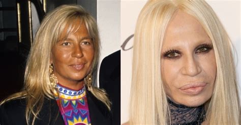 donatella versace antes e depois|donatella versace wikipedia.